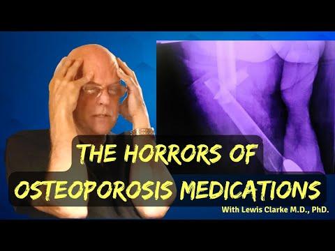 Thumbnail for What They Aren't Telling You About Osteoporosis Medication
