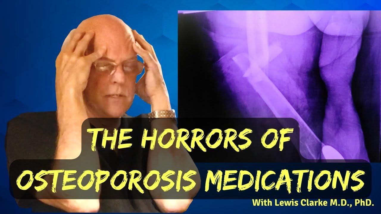 Thumbnail for What They Aren't Telling You About Osteoporosis Medication