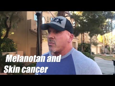 Thumbnail for “Melatonin and Skin Cancer” | #RhinosRhants #TenTalks