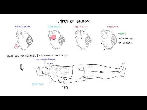 Thumbnail for Approach to Shock - types, hypovolemic, cardiogenic, distributive, anaphylaxis, pathology, treatment