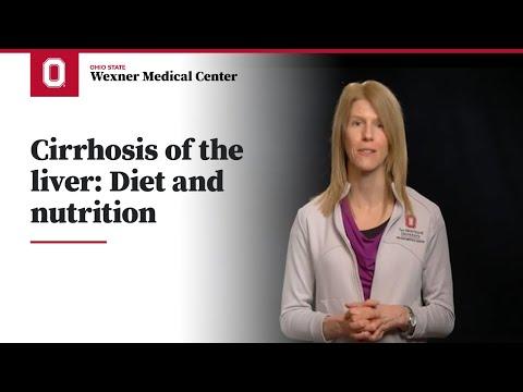 Thumbnail for Cirrhosis of the liver: Diet and nutrition | Ohio State Medical Center
