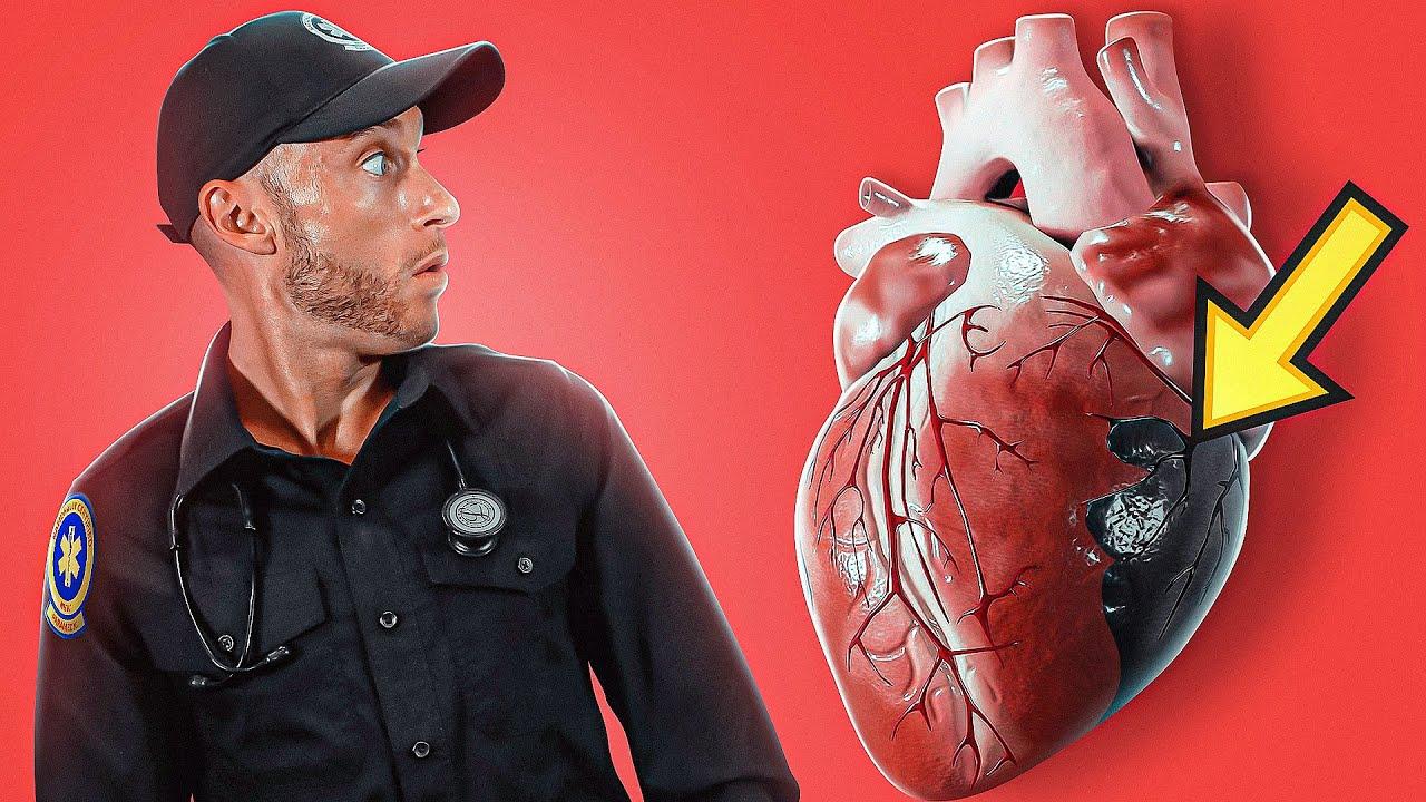 Thumbnail for CARDIOGENIC SHOCK Explained In Under 6 Minutes