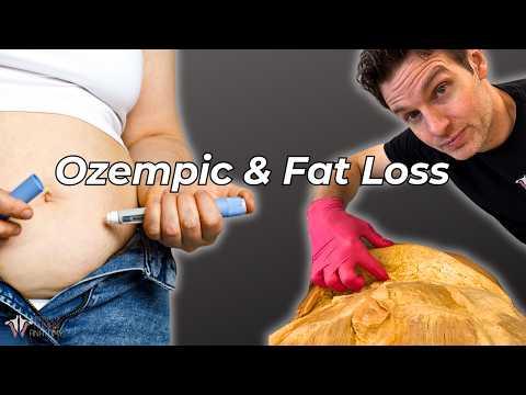 Thumbnail for What Ozempic &amp; Weight Loss Drugs Really Do to the Body