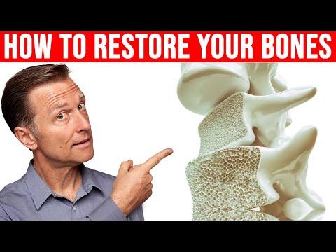 Thumbnail for The TRUTH About Osteoporosis and Osteopenia